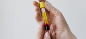 trattamento-prp-centro-medico-corte-della-salute-rigenerativa-terapia-bollate-medical-group